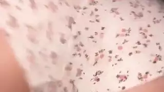 مساج وينك في الفندق